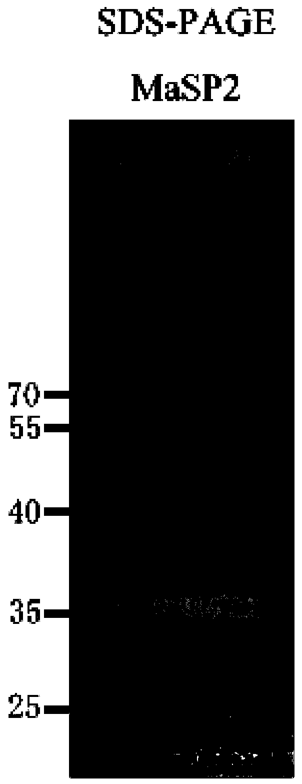 Anti-radiation fabric and preparation method thereof