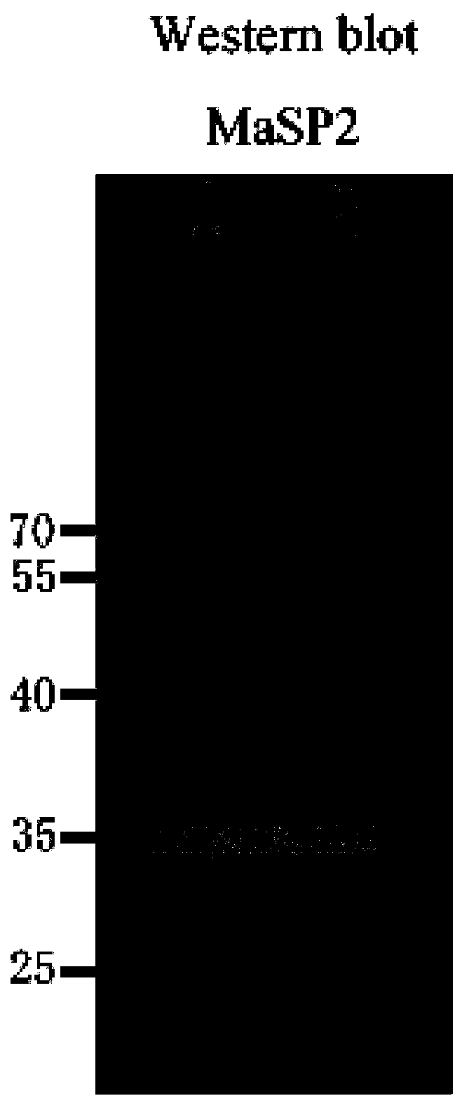 Anti-radiation fabric and preparation method thereof