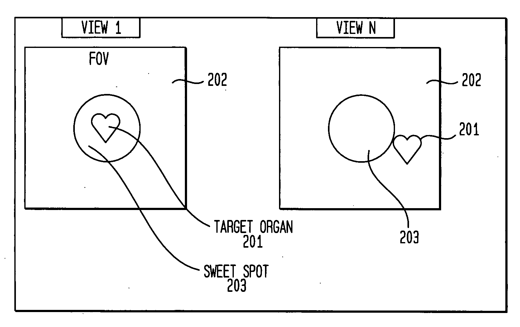 Tracking region-of-interest in nuclear medical imaging and automatic detector head position adjustment based thereon