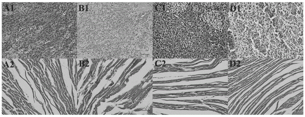 Lf-HA-DOX macromolecule prodrug compound, constructing method thereof and application of Lf-HA-DOX macromolecule prodrug compound to treating glioma