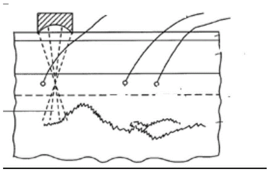 Ultrasonic treatment handle