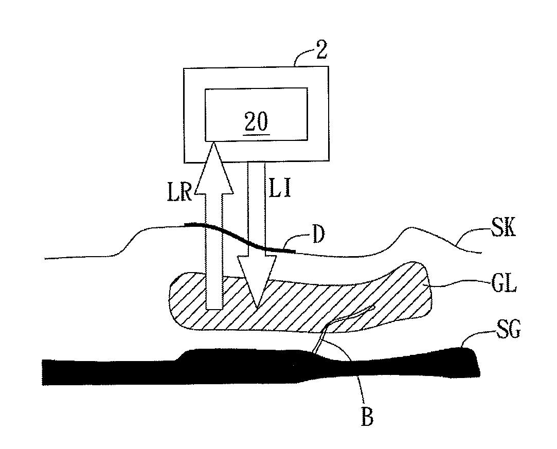 Optical blood glucose detecting apparatus and operating method thereof