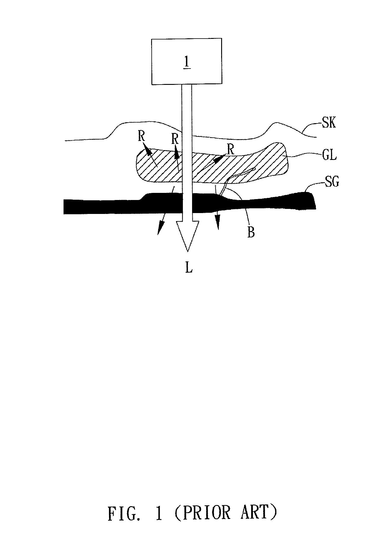 Optical blood glucose detecting apparatus and operating method thereof