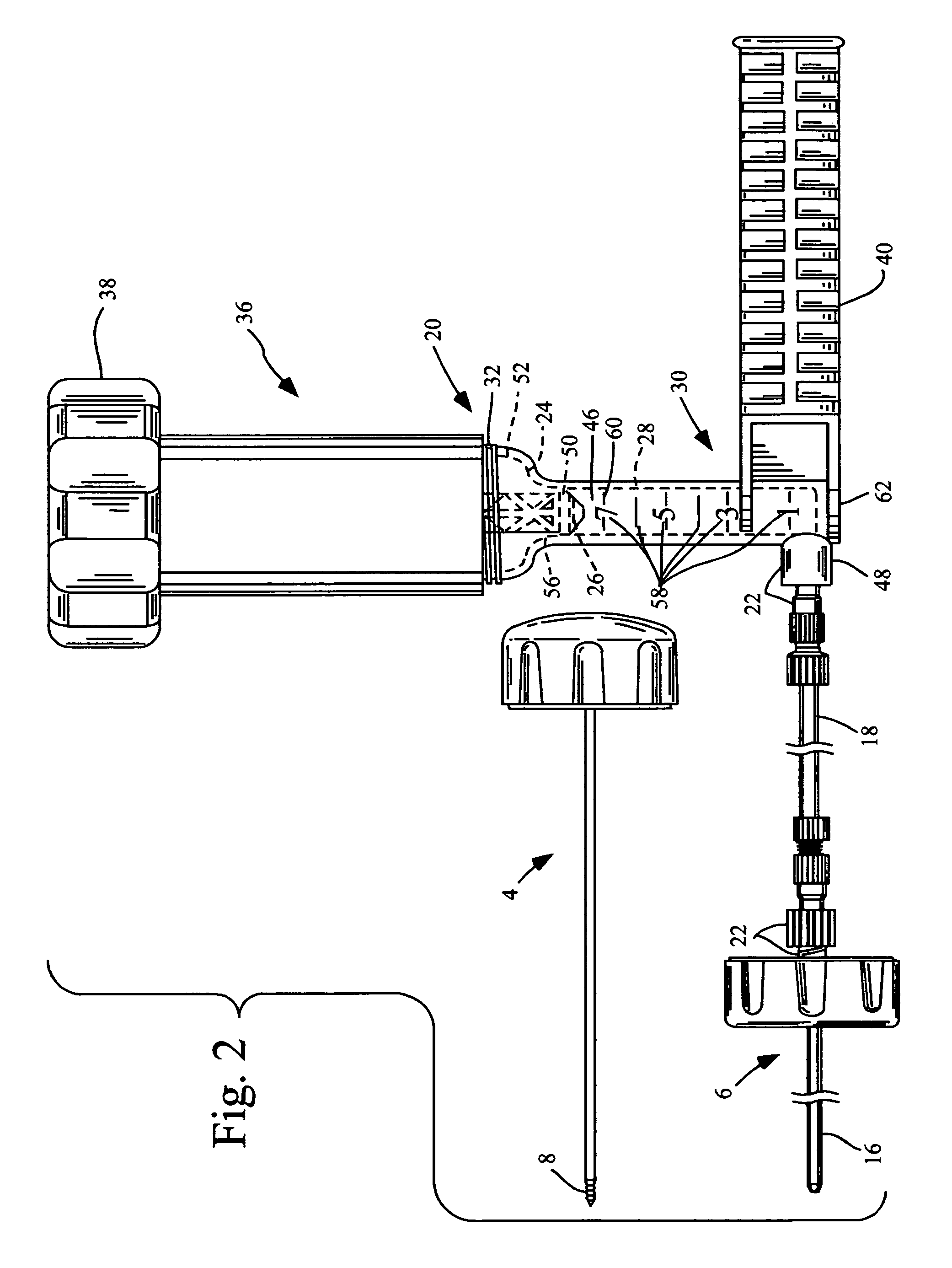 Methods for delivering tissue implant material with a high pressure applicator