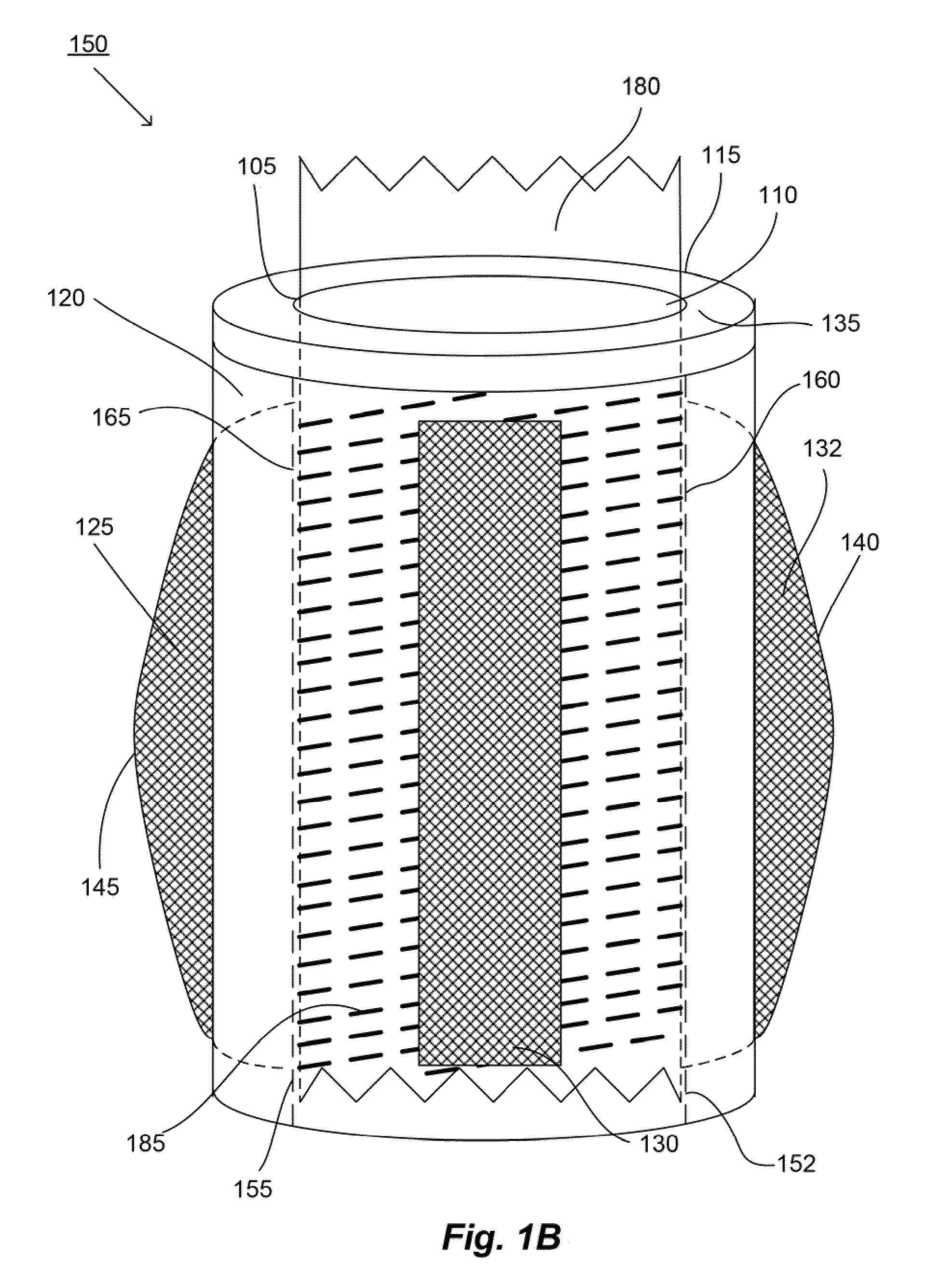 Systems and methods for the medical treatment of structural tissue