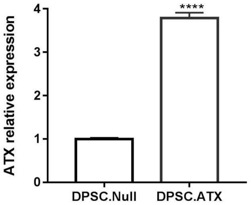 Recombinant mesenchymal stem cell, function-enhanced exosome as well as preparation method and application of function-enhanced exosome