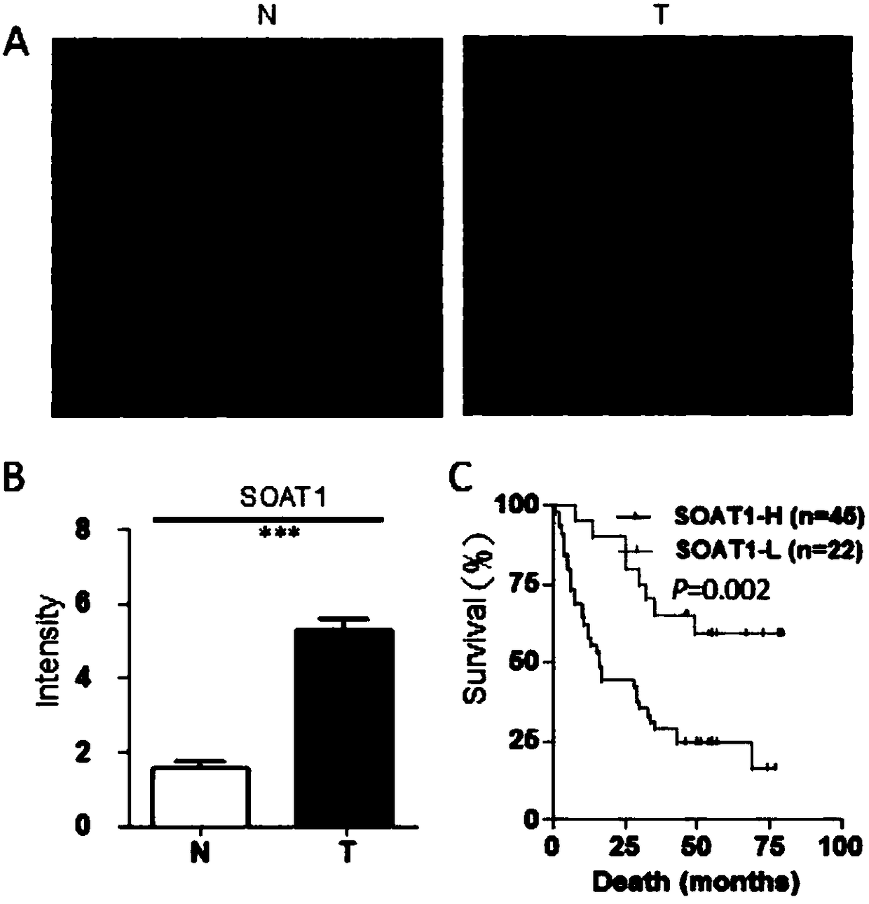 New application of acyl coenzyme A/cholesterol acyltransferase-1 inhibitor