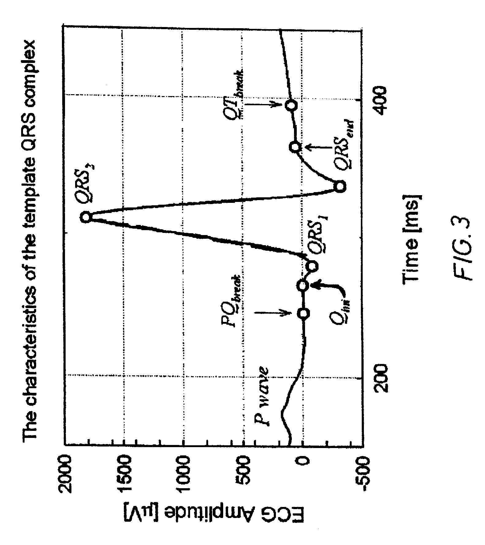 Multi-channel system for beat to beat QT interval variability