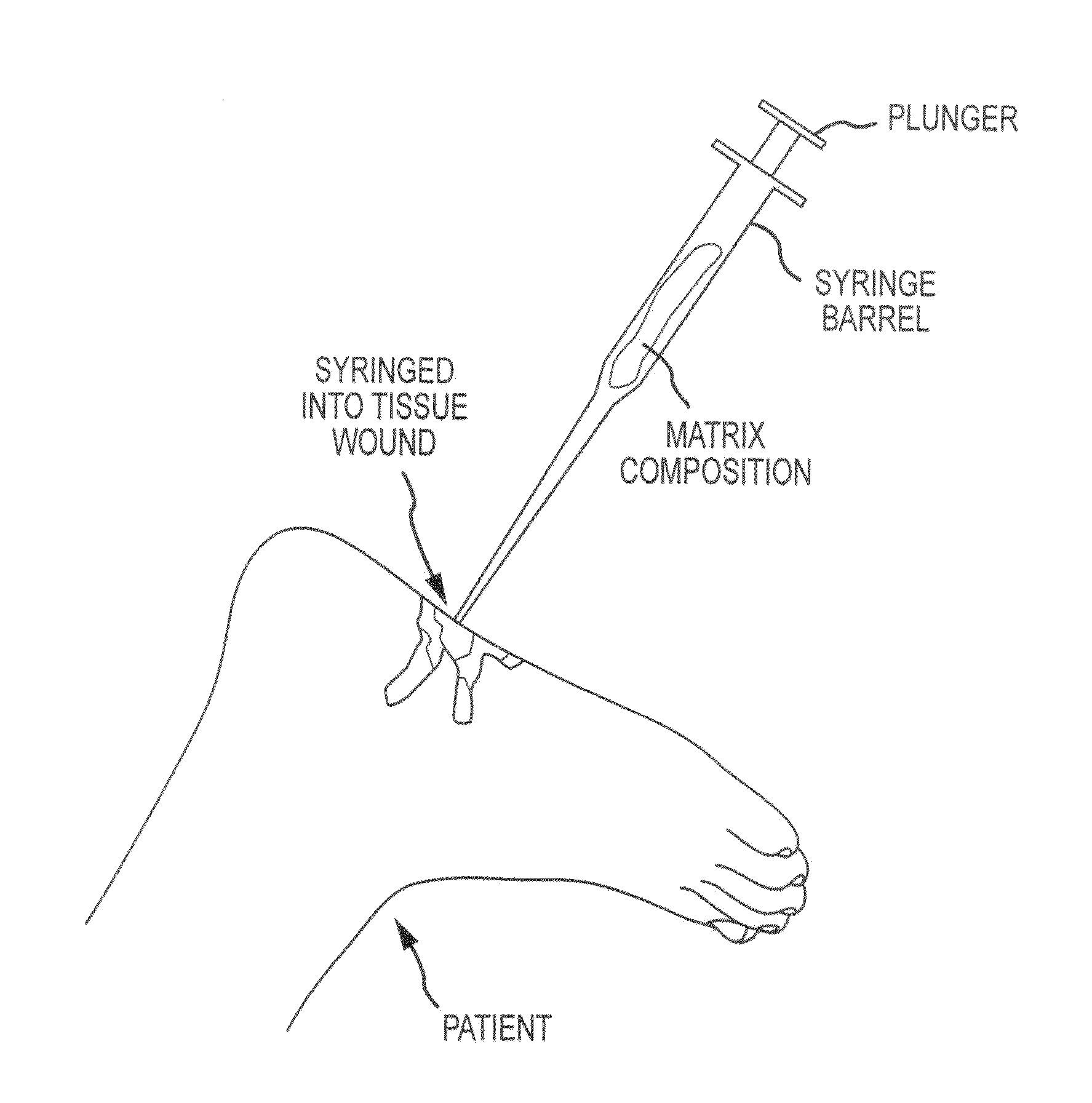 Flowable matrix compositions and methods