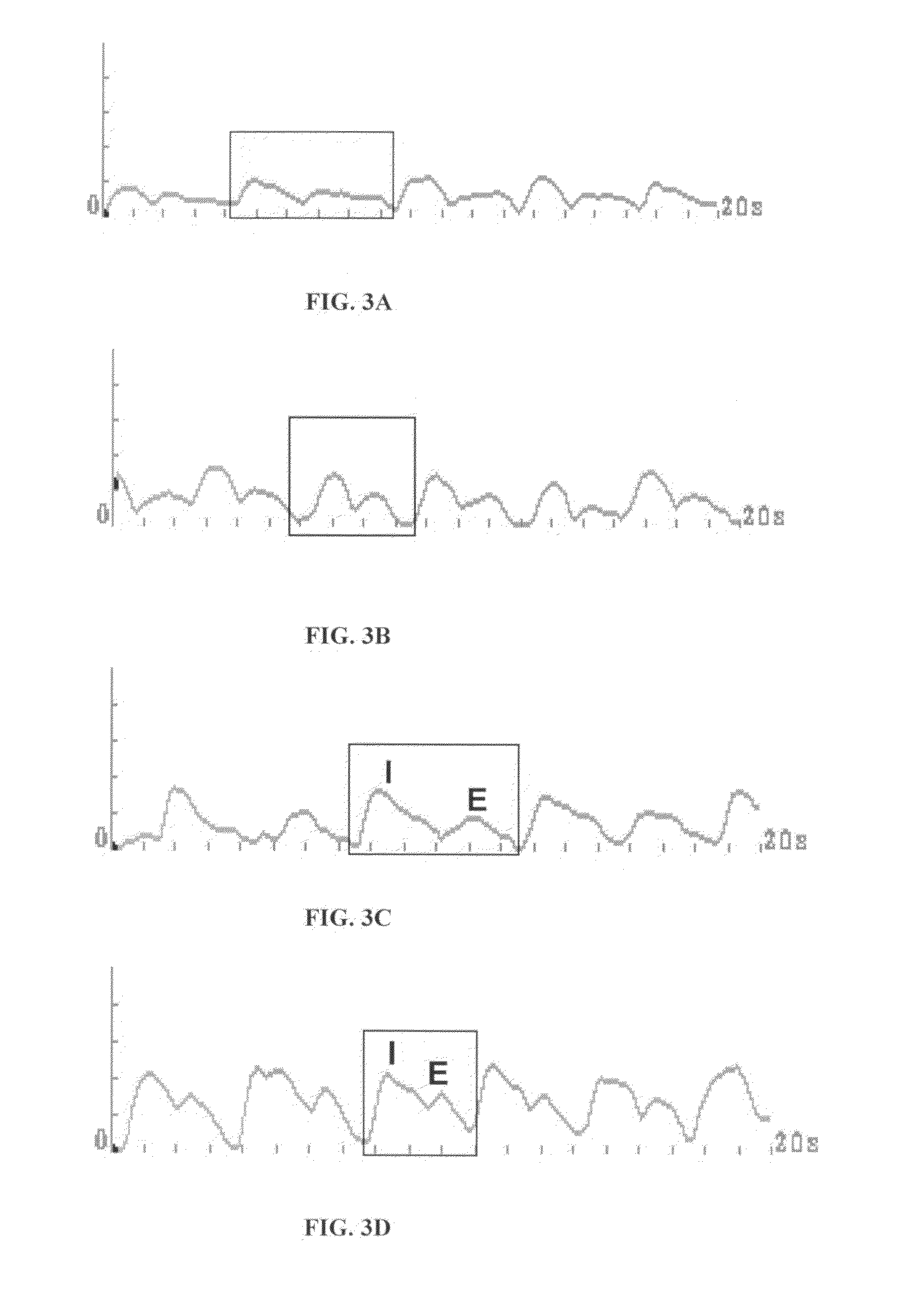 Method and System for Assessing Lung Condition and Managing Mechanical Respiratory Ventilation