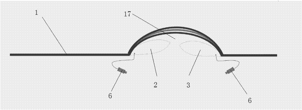 Radial artery dual-airbag intelligent compression hemostasis device