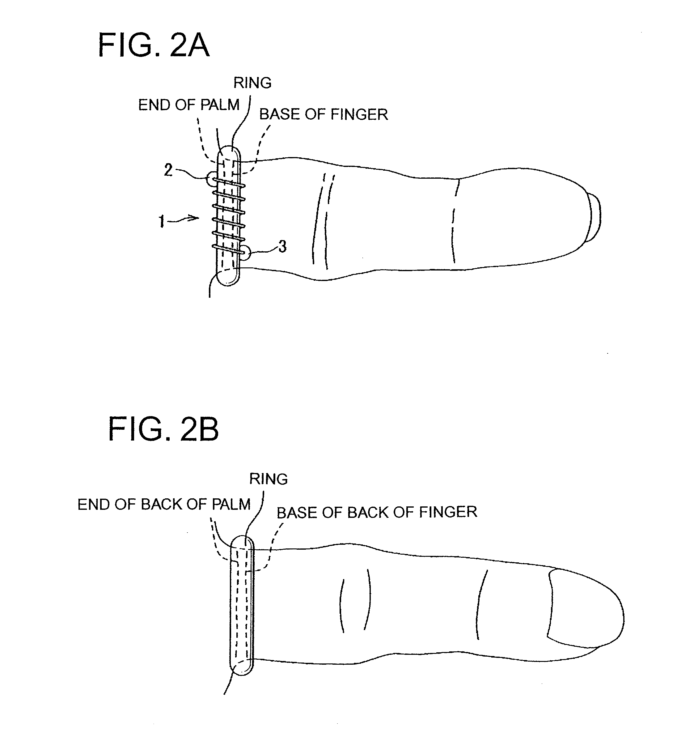 Fitting device for ring