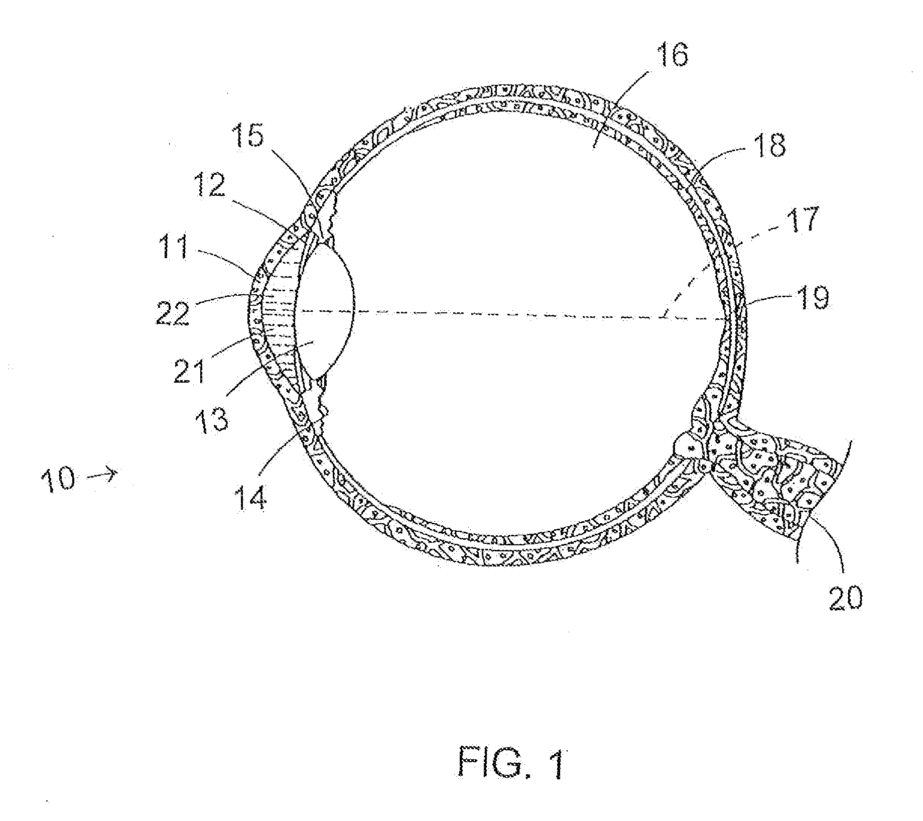 Methods and patterns for increasing amplitude of accommodations in a human lens