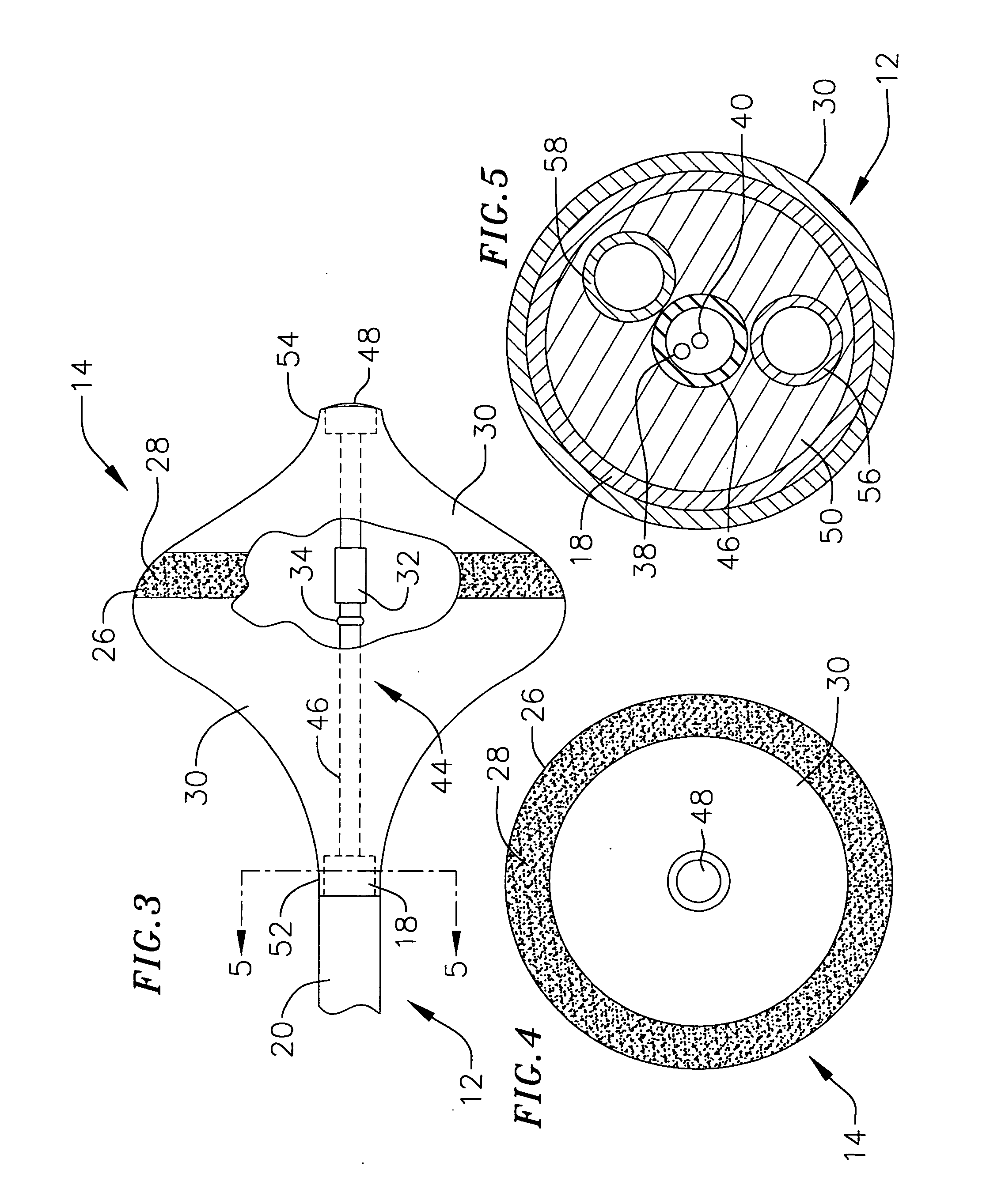 Surgical probe for supporting inflatable therapeutic devices in contact with tissue in or around body orifices and within tumors