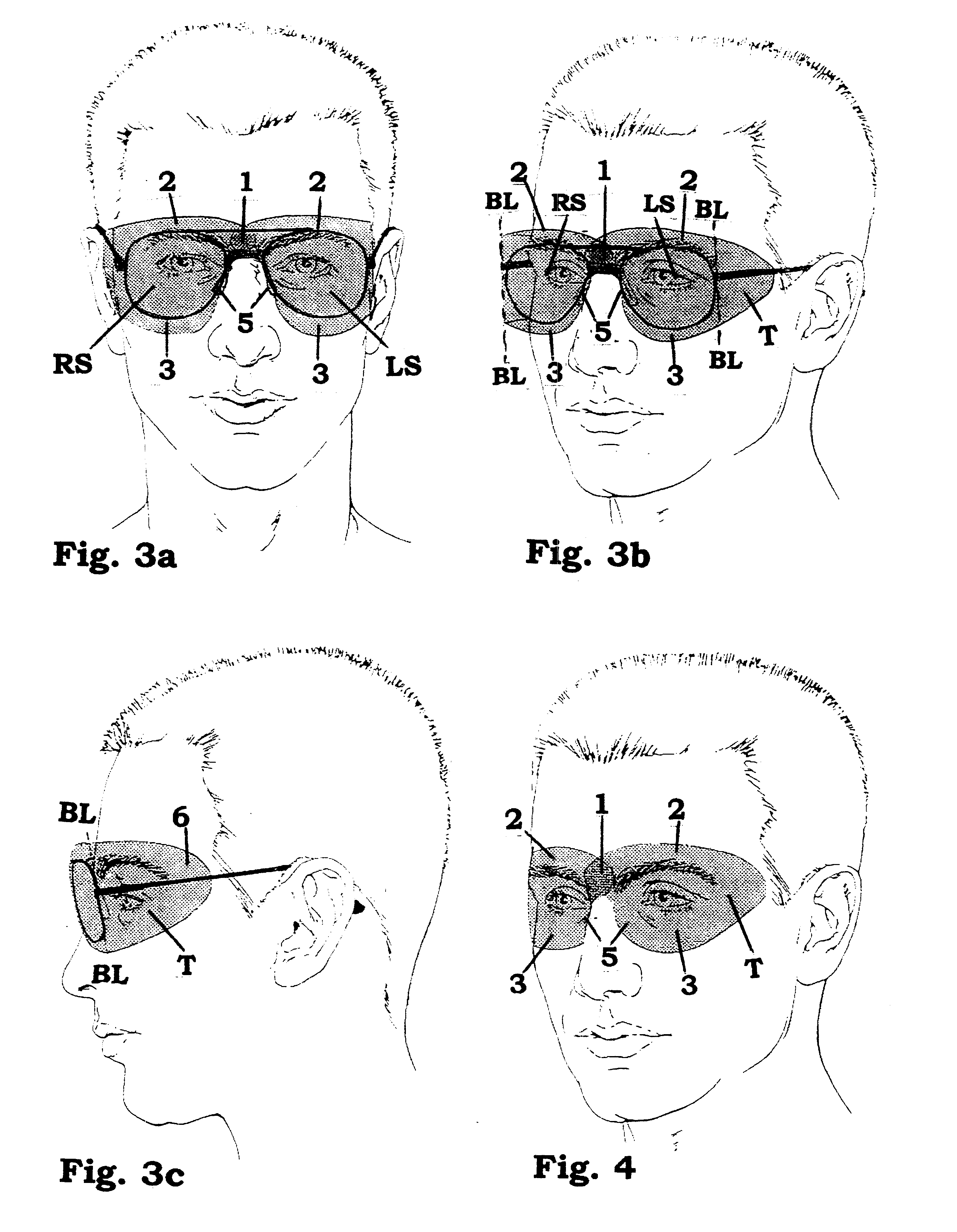 Temporary, disposable glare shield for eyeglasses