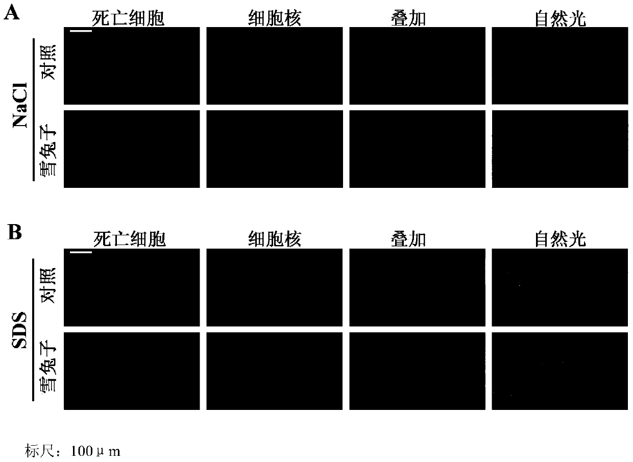 Application of Tibet saussurea laniceps extract to relieving fruit fly intestinal inflammation