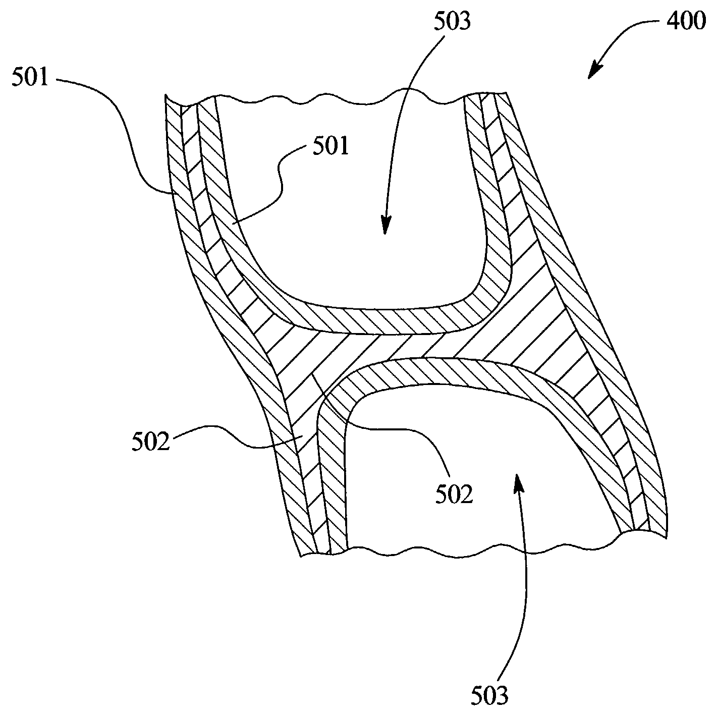 Orthodontic appliance, a system and a method for automatically straightening teeth