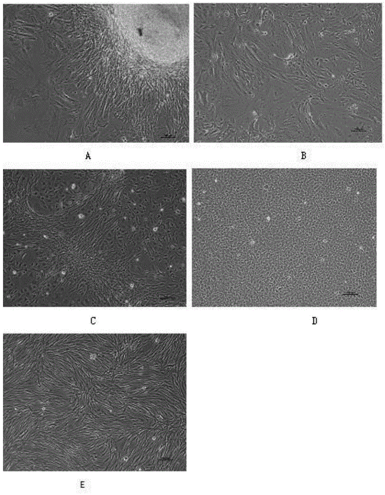 Grass carp swim bladder epithelioid cells line and application