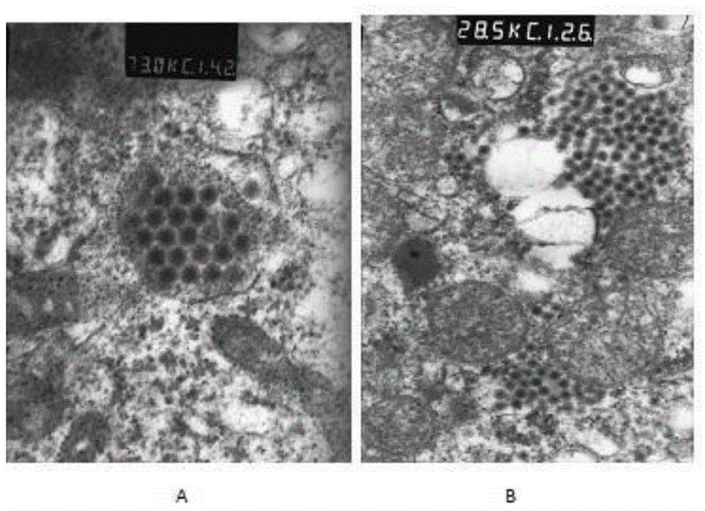 Grass carp swim bladder epithelioid cells line and application