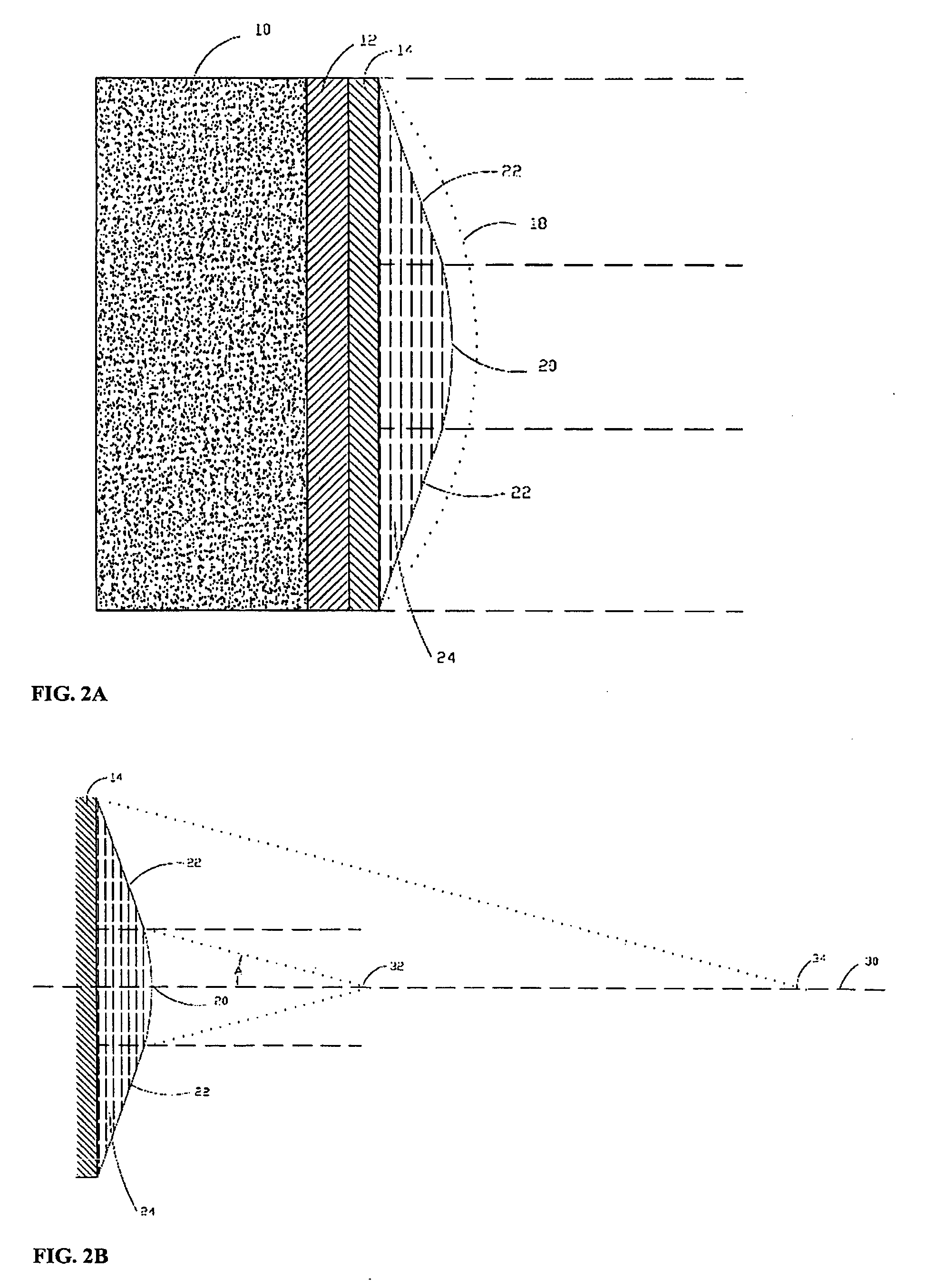 Continuous-focus ultrasound lens