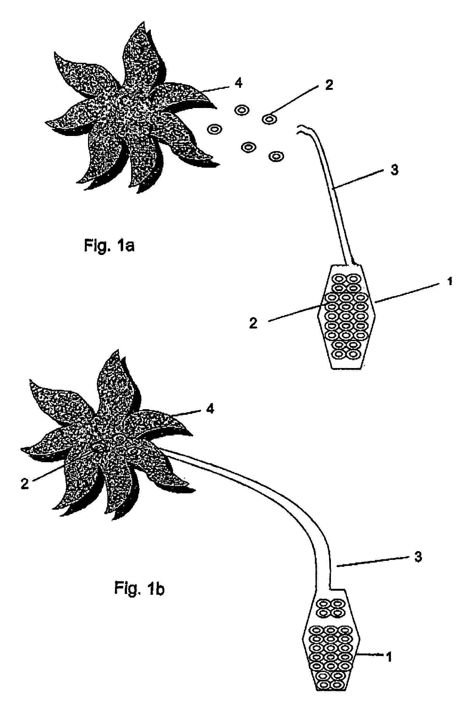 Controlled and directed local delivery of anti-inflammatory compositions