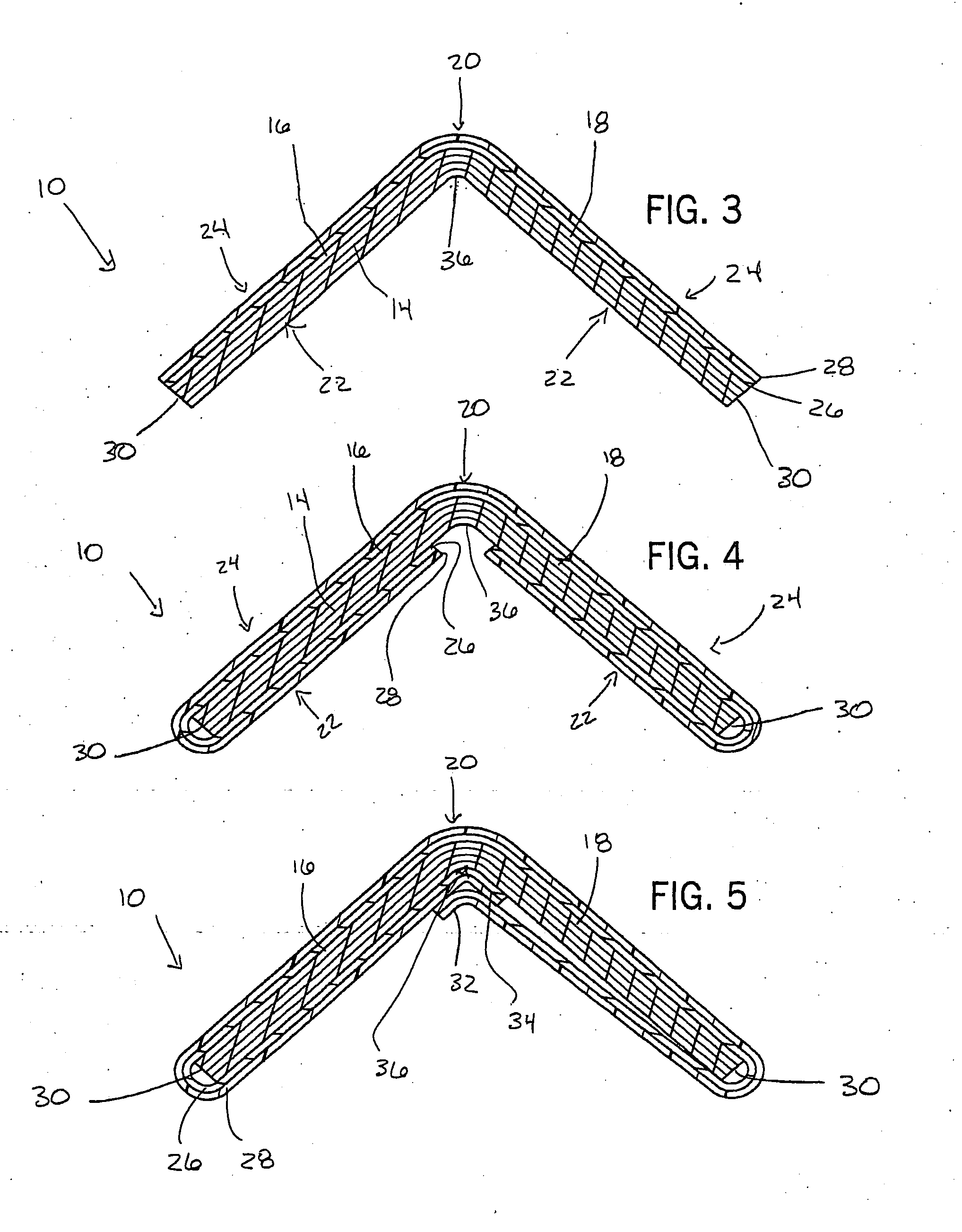 Plastic laminated edge protector