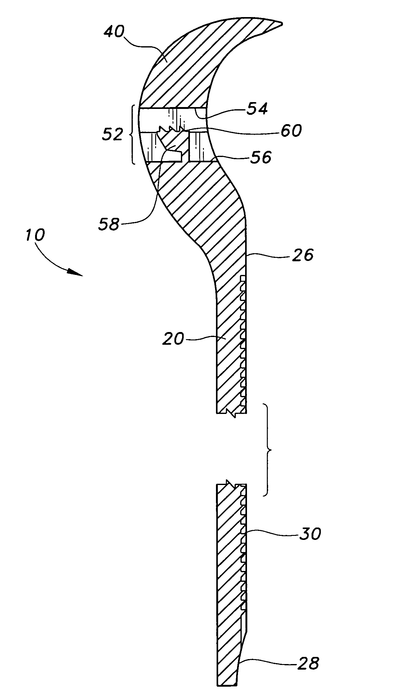 Bio-absorbable bone tie with convex head