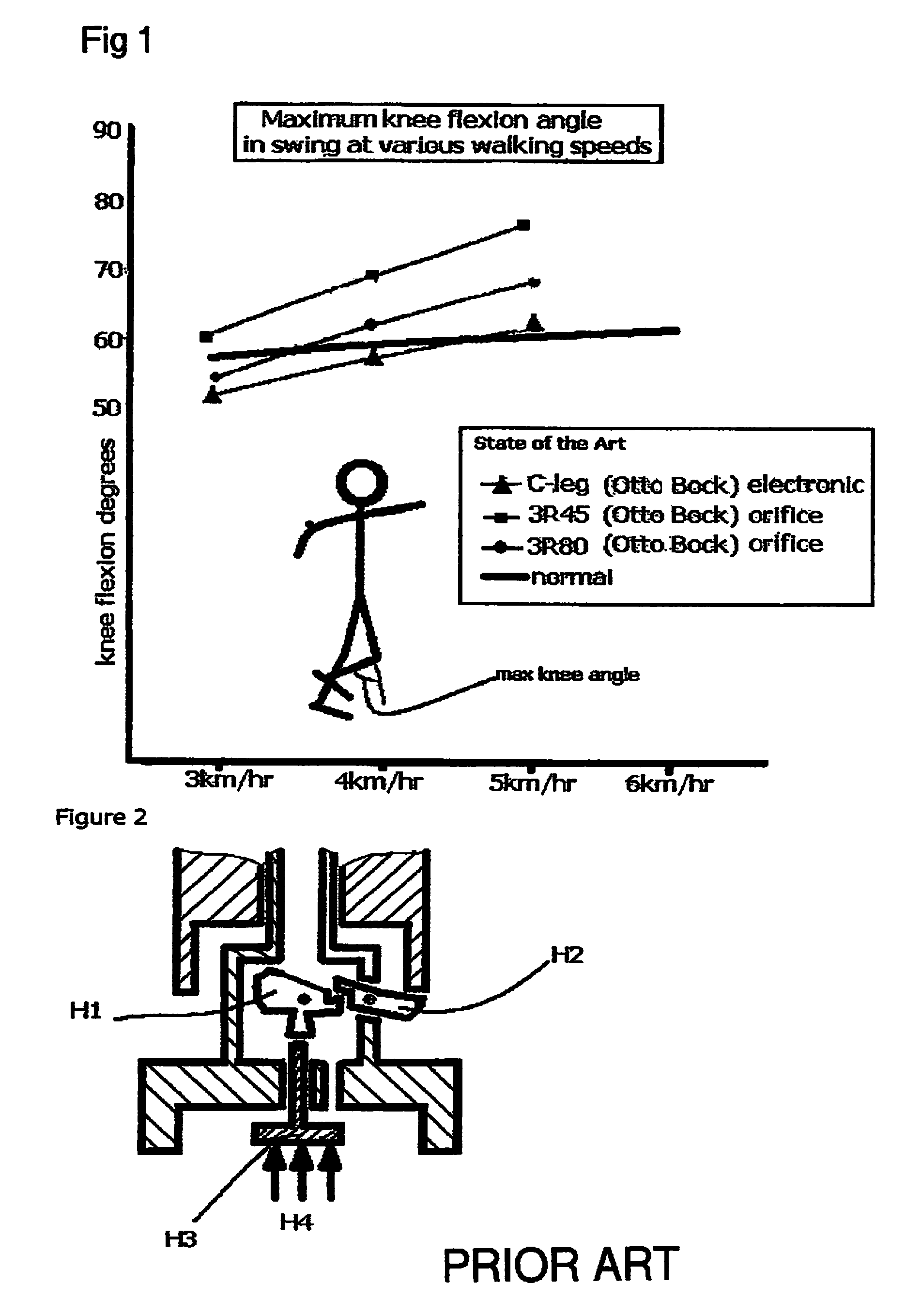 Hydraulic prosthetic joint