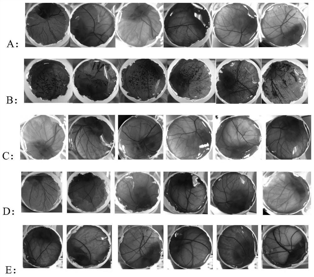 Application of ganoderma lucidum peptide polysaccharide in preparation of skin histamine inhibitor