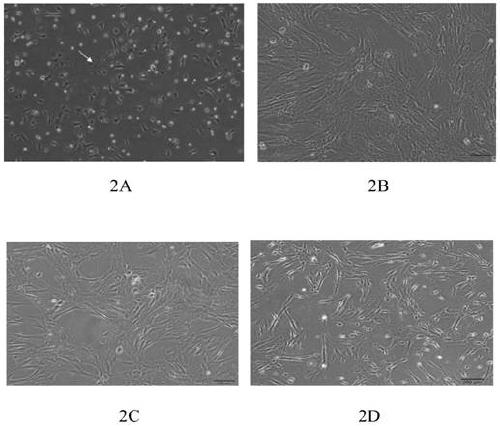 A serum-free step-by-step culture method of huc-msc and huc-msc obtained by said method