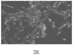 A serum-free step-by-step culture method of huc-msc and huc-msc obtained by said method