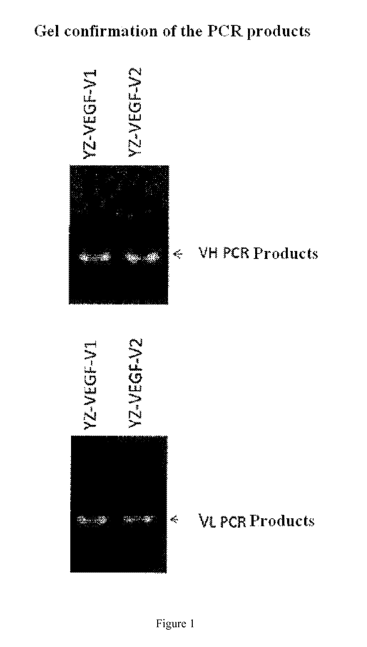 Epidermal growth factor receptor antibody