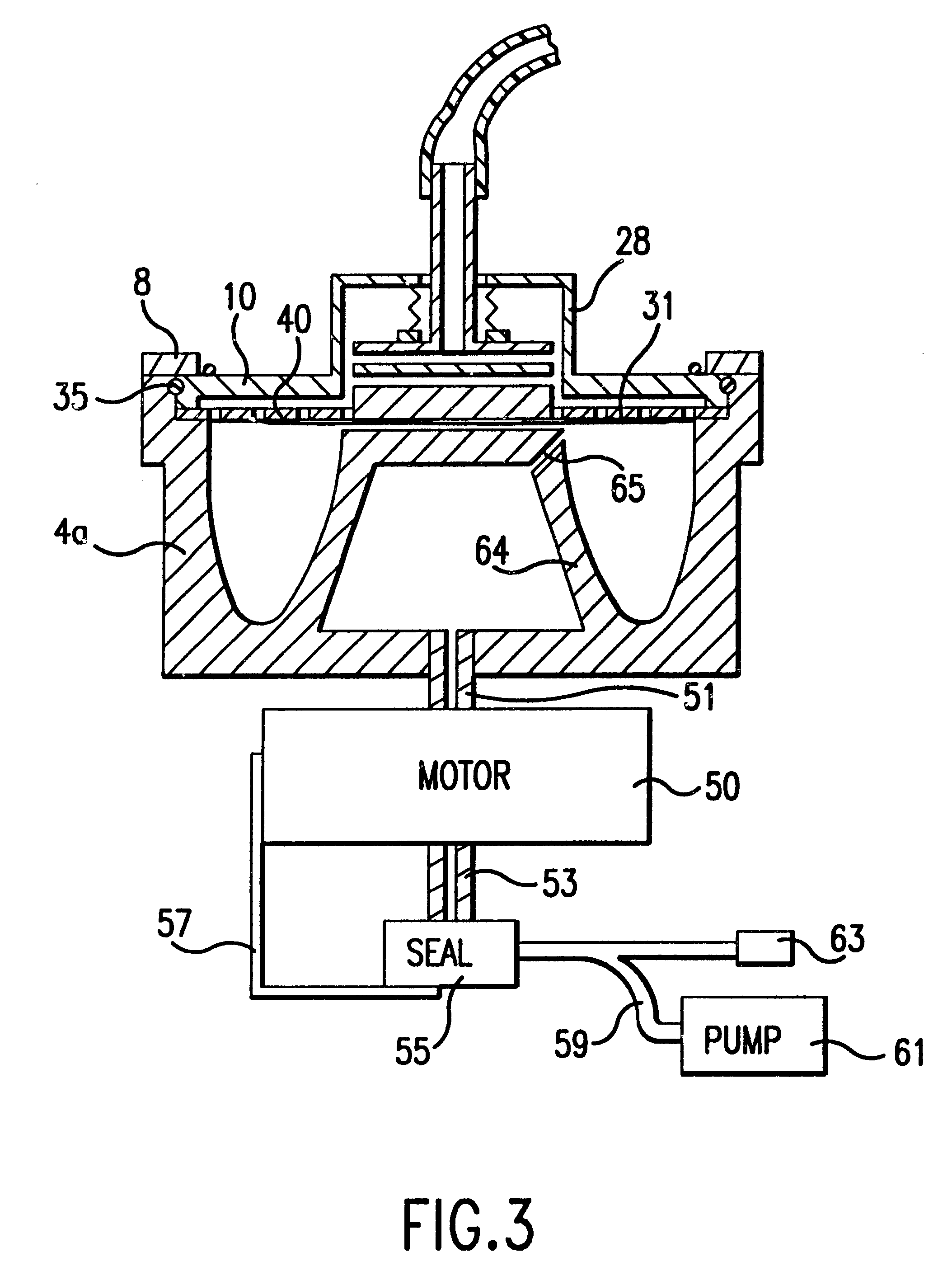 Rotor with elastic diaphragm defining a liquid separating chamber of varying volume