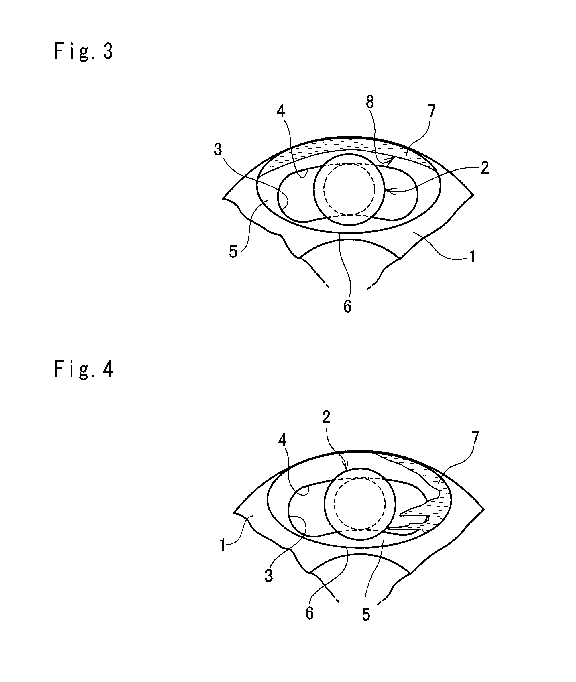 Torsional vibration damping device