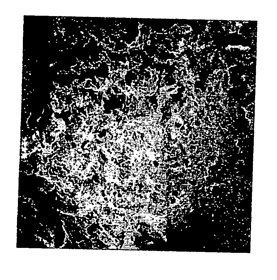 Porous particulate collagen sponges