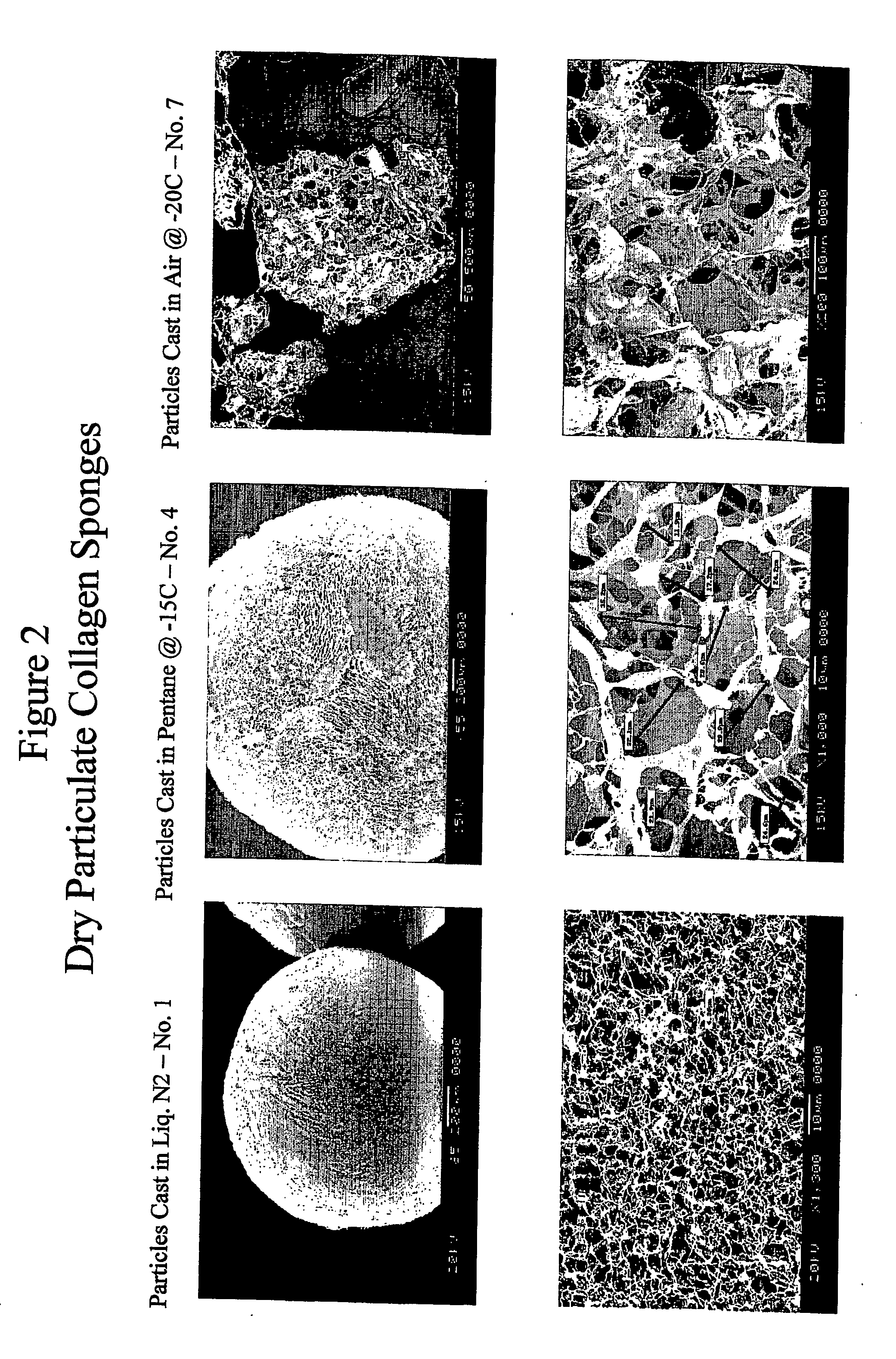 Porous particulate collagen sponges