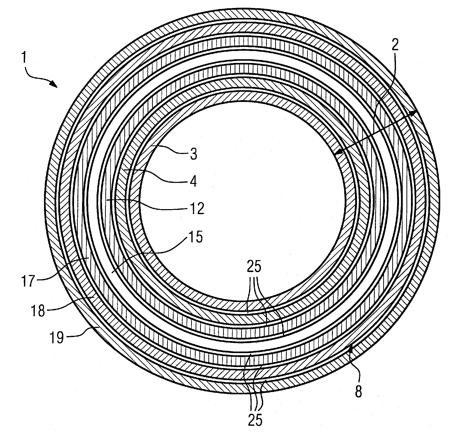 Gradient coil system and mr imaging system embodying same