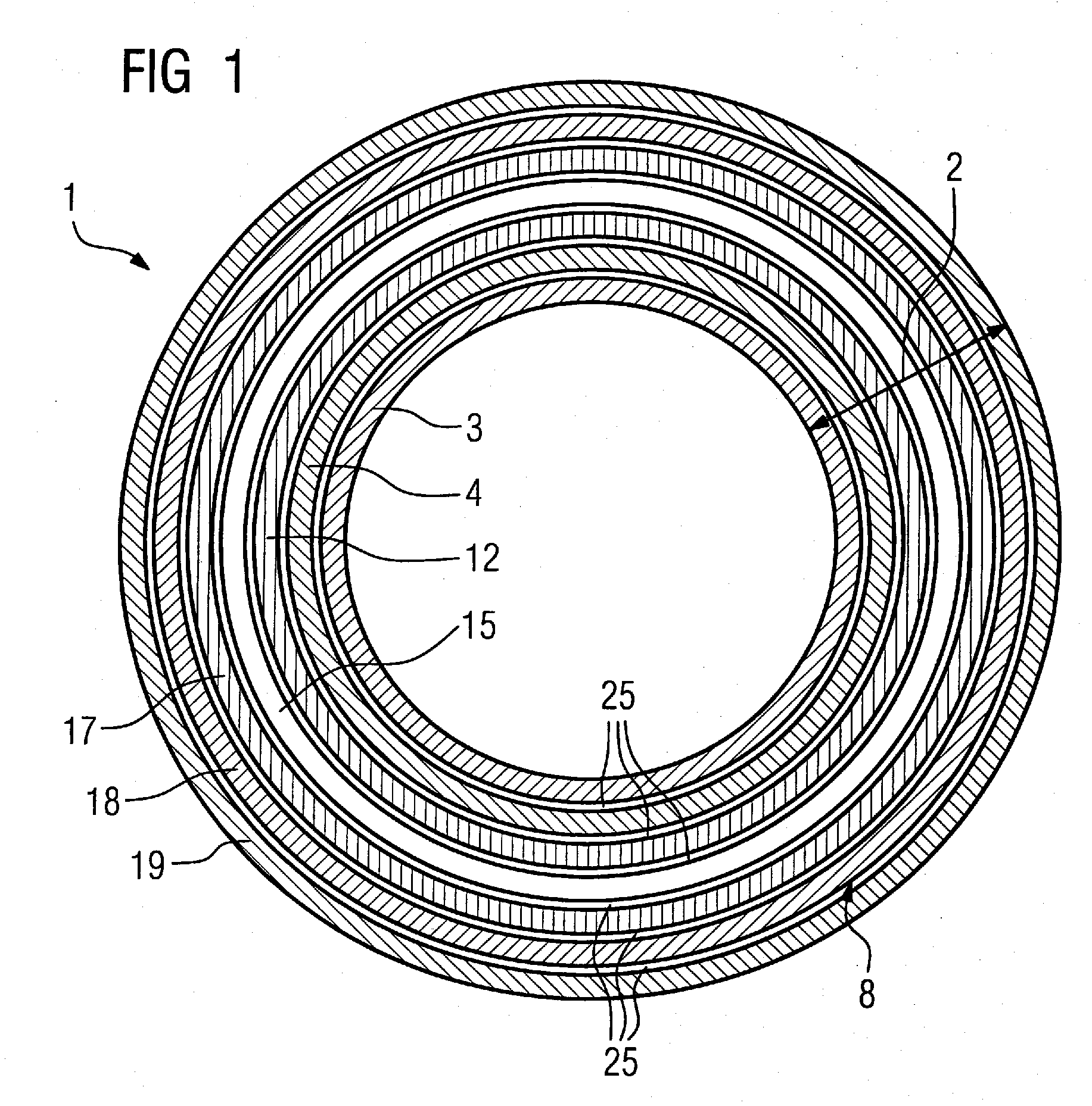 Gradient coil system and mr imaging system embodying same