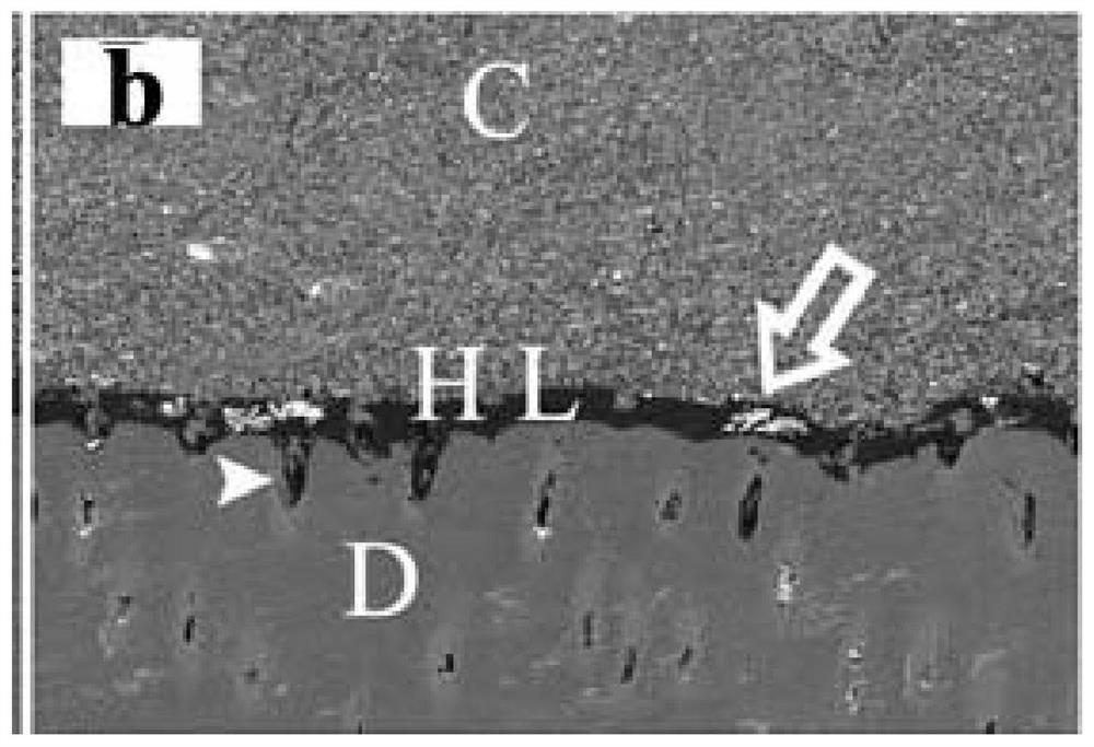 Dental resin adhesive containing unsaturated fatty acid polyphenolamide derivatives