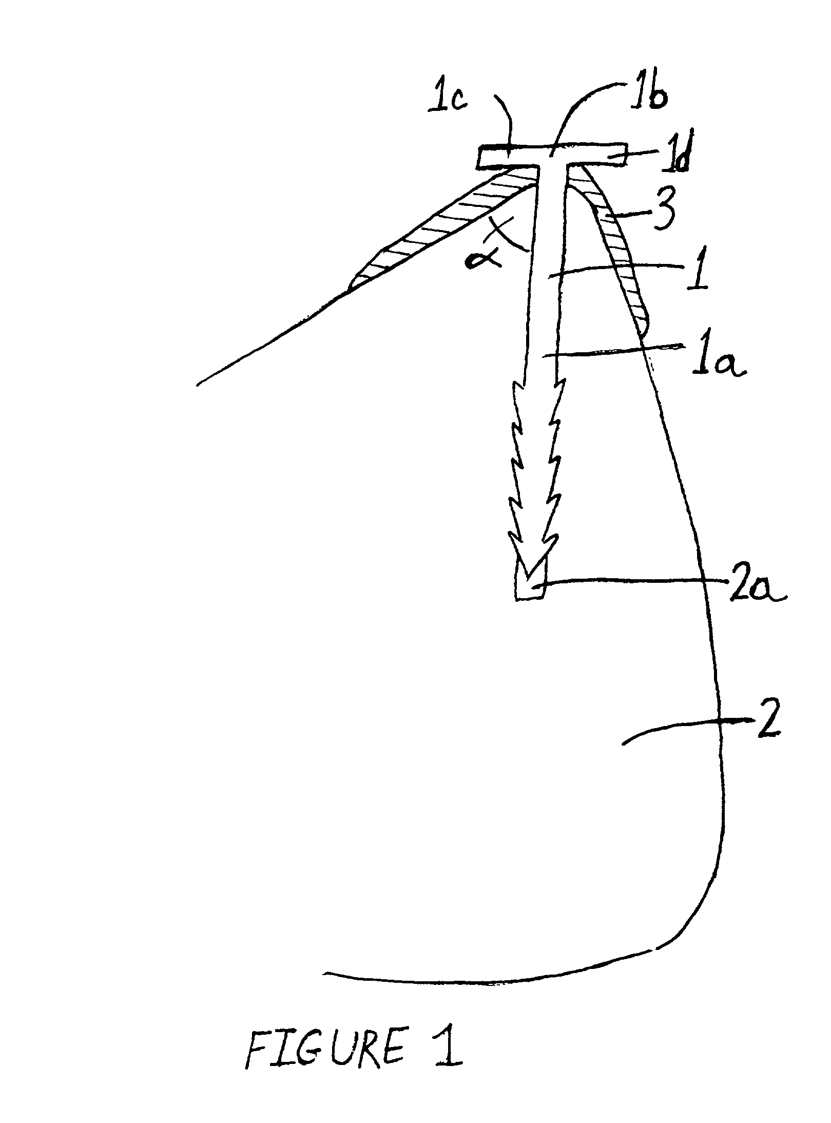 Anatomical fixation implant