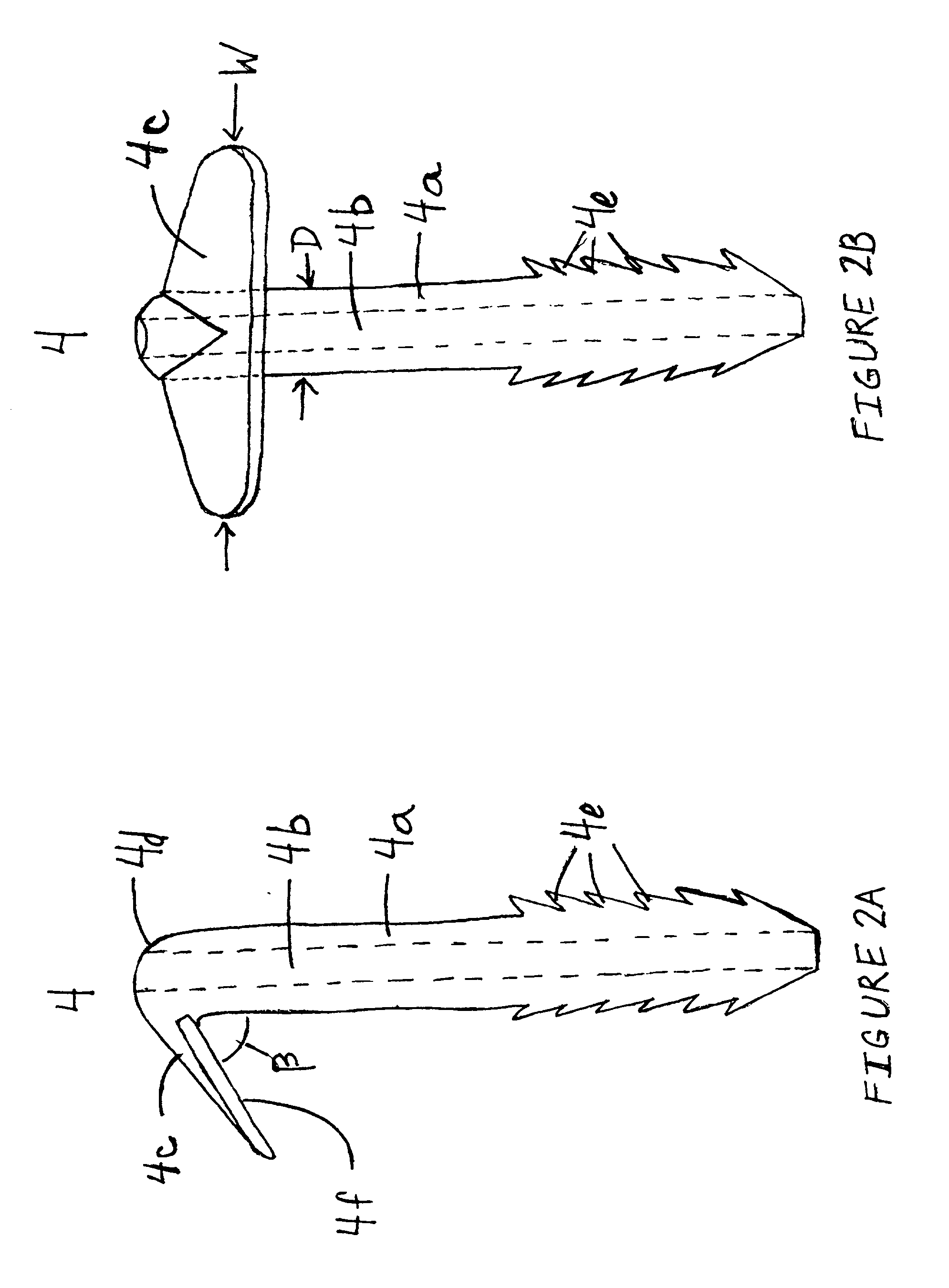 Anatomical fixation implant