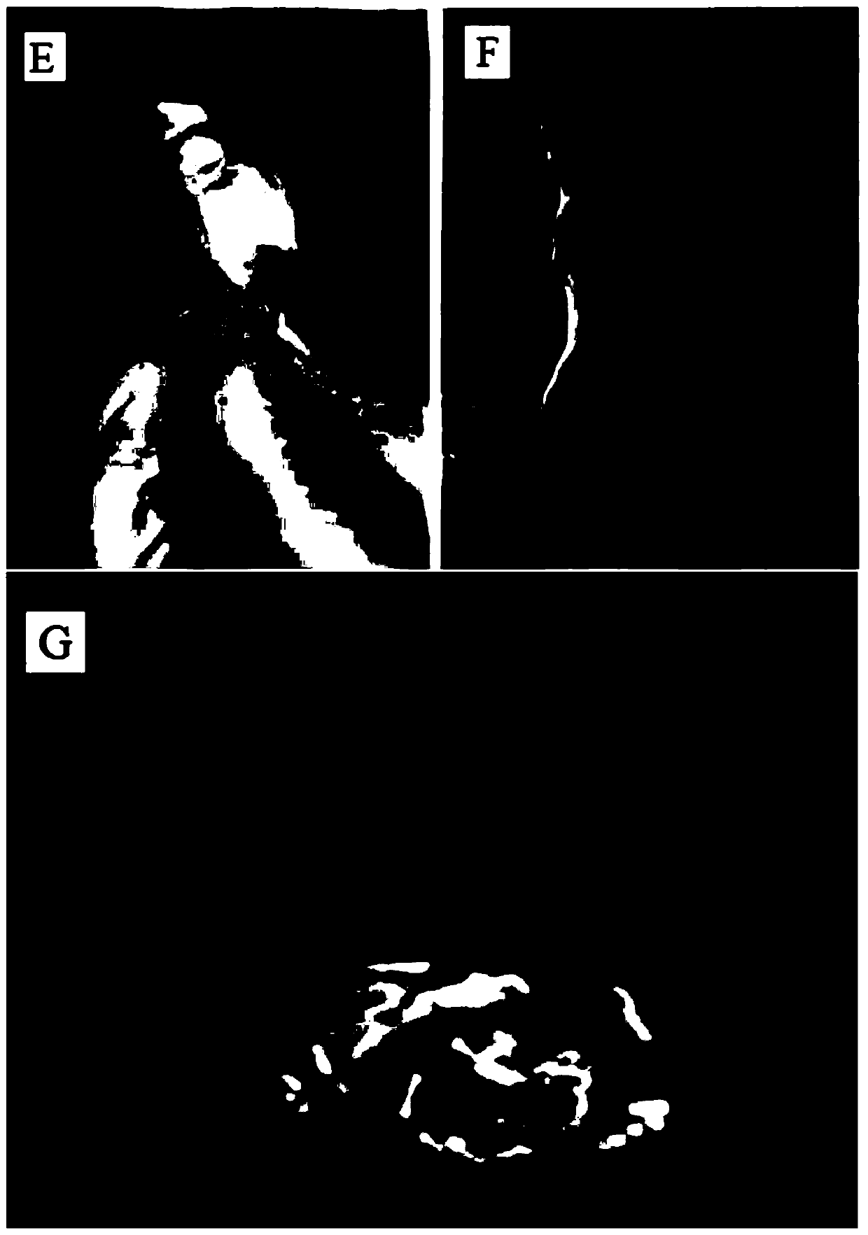 Construction method and application of synovial sarcoma heterogenous transplanting mouse model