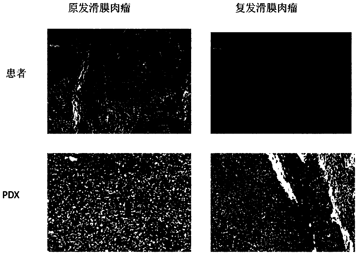 Construction method and application of synovial sarcoma heterogenous transplanting mouse model