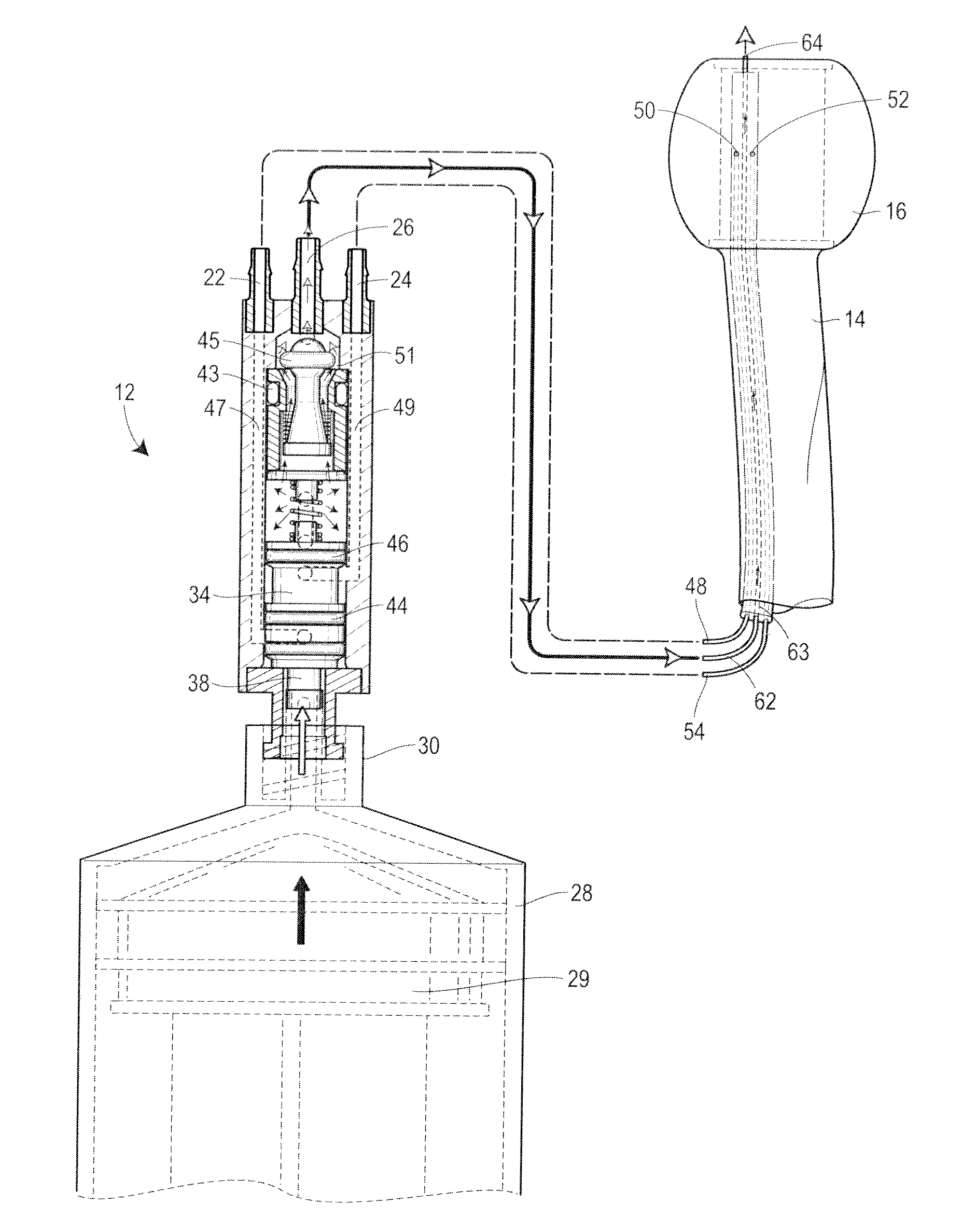 Inflation cuff with transient-resistant over-pressure preventor