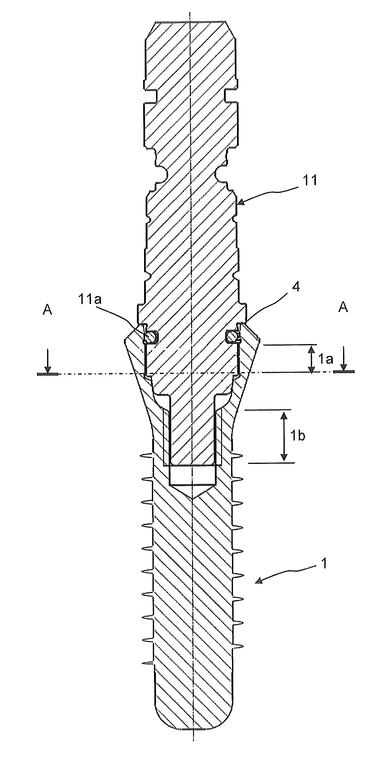 Dental implant socket arrangement