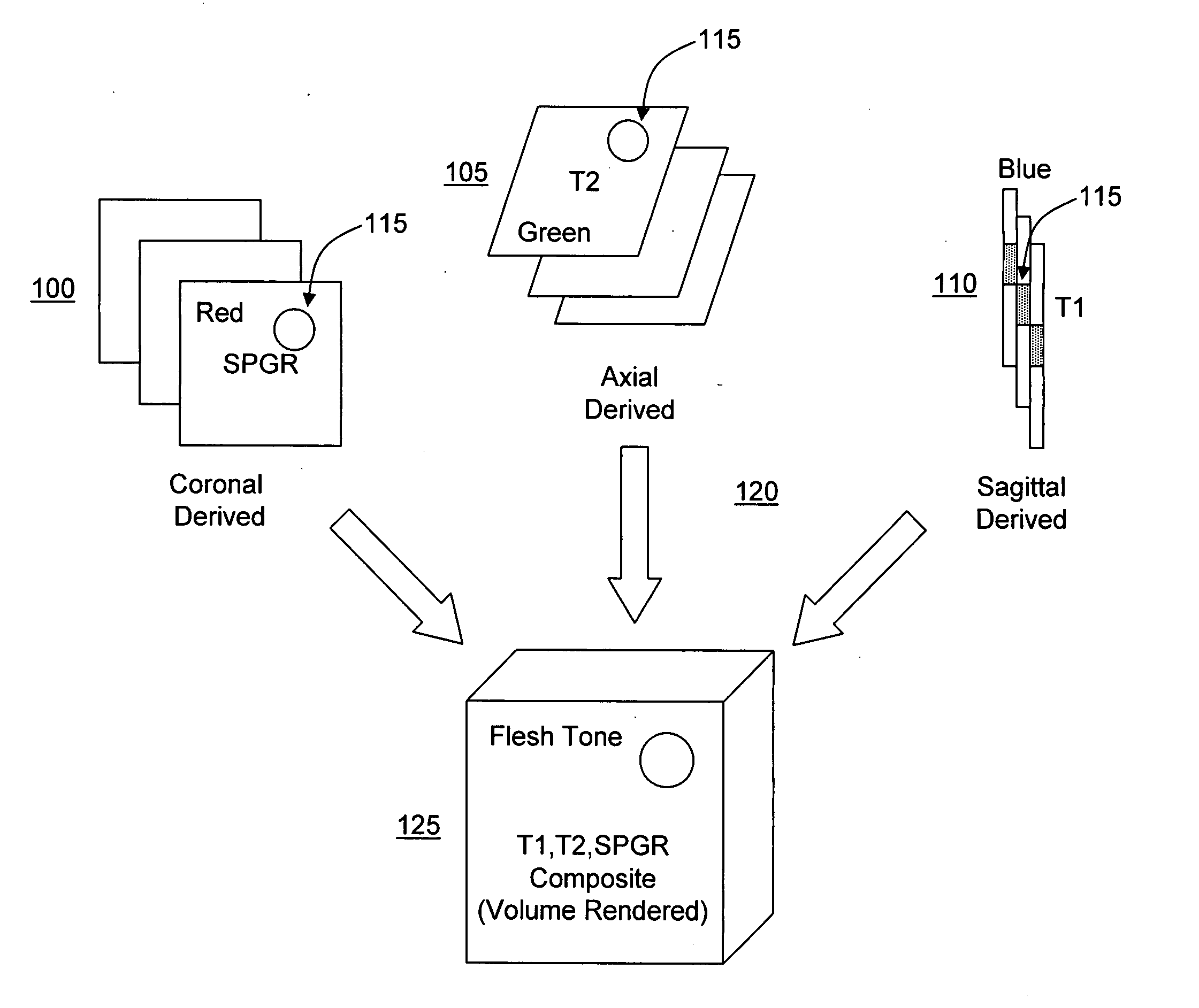 Opposed orthogonal fusion system and method for generating color segmented MRI voxel matrices