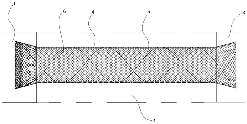 Intracranial vascular stent