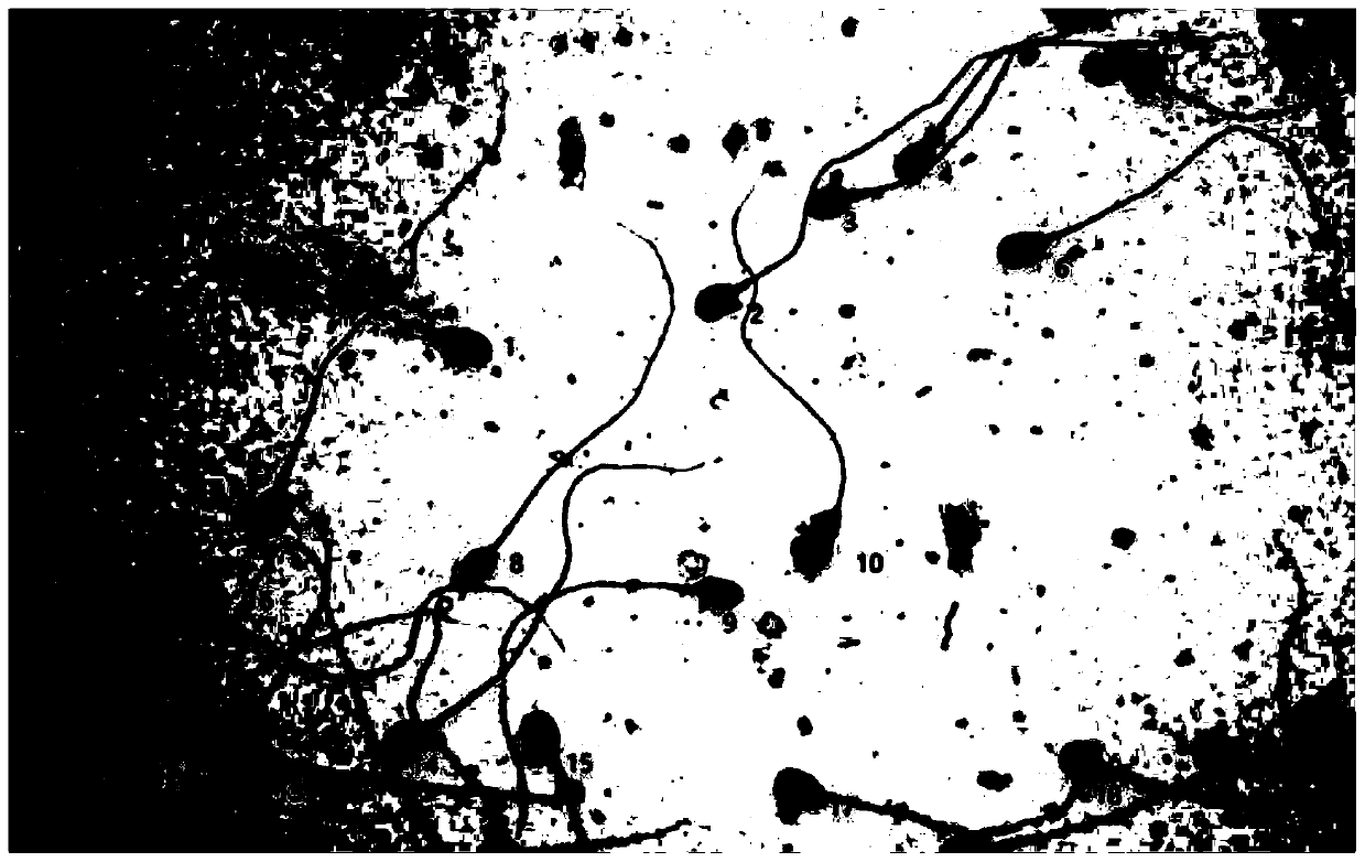 Method for identifying and classifying sperms in morphological image