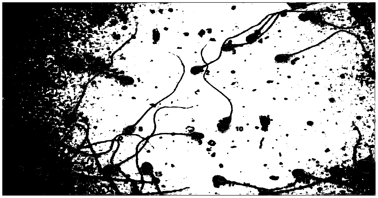 Method for identifying and classifying sperms in morphological image