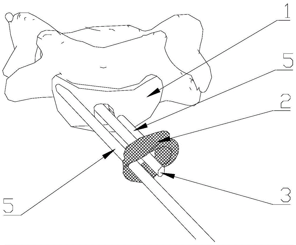 Navigation template for vertebral pedicle locating and real-time screw path monitoring and manufacturing method thereof